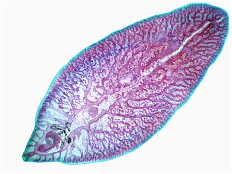  Japanese Lancet Liver Fluke: A Microscopic Marvel That Lurks In Freshwater Snails And Craves Mammalian Livers!