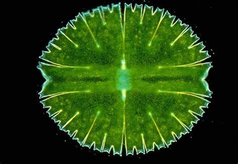  Micrasterias!  A Tiny Spiky Disk That Lives In Freshwater Lakes?