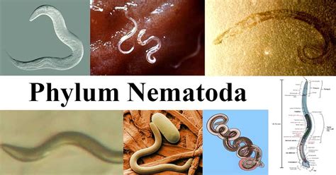  Nematoda! Những Con Sâu Trắng Trong Suốt Lại Là Loài Hành Tinh Khác Biệt Nào?