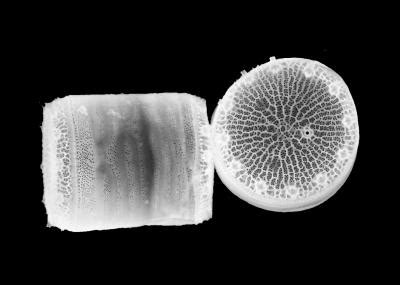  Quasimocola!  A Tiny Flatworm With A Gigantic Appetite For Diatoms